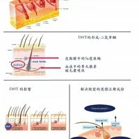 Mediceuticals Hairgain Nutritional Hair Growth Men 60 Tablets 男士膳食補充劑 60粒